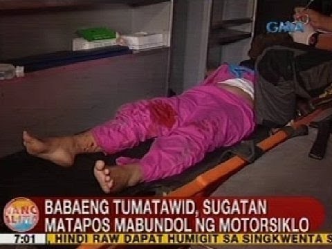UB: Babaeng tumatawid, sugatan matapos mabundol ng motorsiklo sa QC