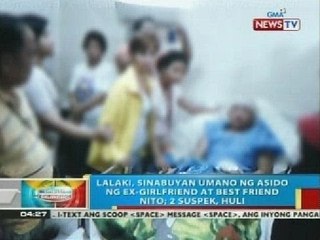 Lalaki sa Valenzuela, sinabuyan umano ng asido ng ex-girlfriend at best friend nito