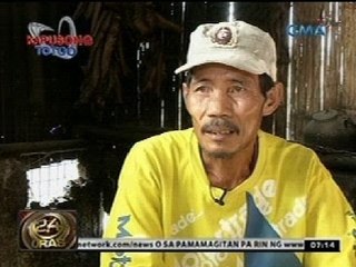 Kapusong Totoo: Dalagang may sakit sa balat, nananawagan ng tulong medikal