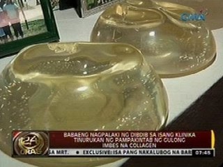 Babaeng nagpalaki ng dibdib sa isang klinika, tinurukan ng pampakintab ng gulong imbes na collagen