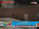 BP: 6 na residente sa Bacolod City, kinagat ng isang aso