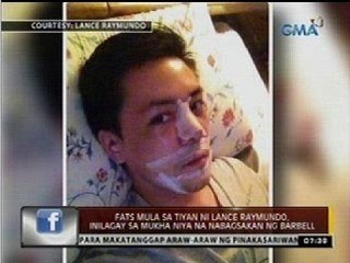 Fats mula sa tiyan ni Lance Raymundo, inilagay sa mukha niya na nabagsakan ng barbell