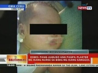 BT: DSWD: Pang-aabuso ang pagpa-plaster ng isang nurse sa bibig ng isang sanggol