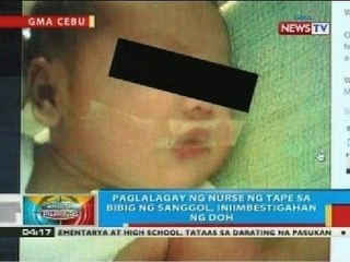 Paglalagay ng nurse ng tape sa bibig ng sanggol sa Cebu City, iniimbestigahan ng DOH
