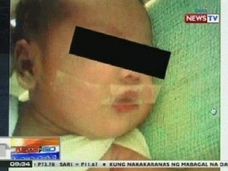 NTG: Sanggol sa Cebu, nilagyan ng plaster sa bibig ng nurse