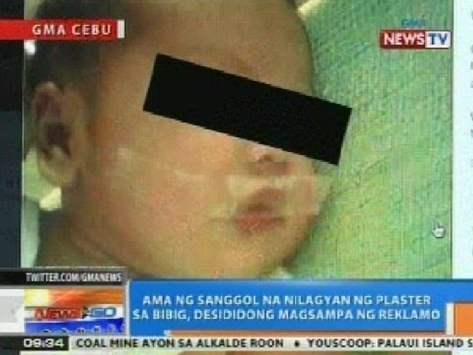 NTG: Ama ng sanggol na nilagyan ng plaster sa bibig, desididong magsampa ng reklamo
