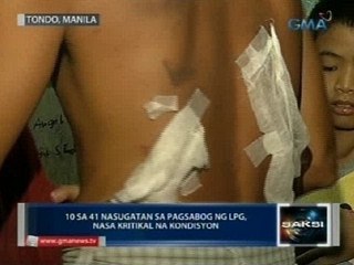 Magkahiwalay na insidente sa Tondo: 10 kritikal sa LPG blast; 5 patay nang ma-trap sa sunog