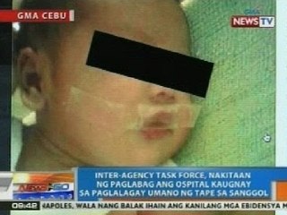 Inter-agency task force, nakitaan ng paglabag ang ospital sa paglalagay umano ng tape sa sanggol