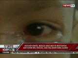 SONA: Estudyante sa Ilocos Norte, maga ang mata matapos batuhin ng visual aid ng guro