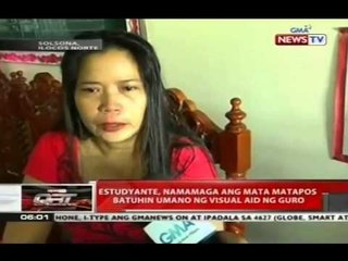 Estudyante, namamaga nag mata matapos atuhin umano ng visual aid ng guro