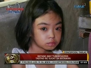 24 Oras: Batang may tuberculosis, tadtad ng sugat sa katawan