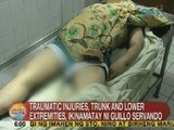 Alleged hazing victim Servando, namatay dahil sa traumatic injuries sa trunk and lower extremities