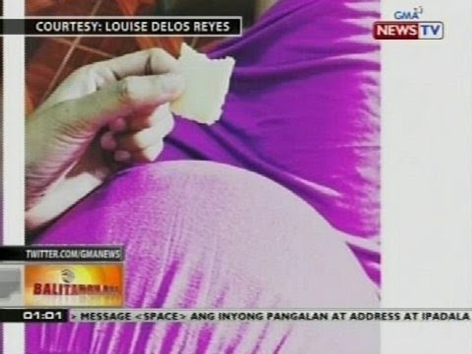 BT: Instagram post ni Louise Delos Reyes na buntis, naging usap-usapan