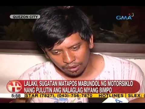 UB: Lalaki, sugatan matapos mabundol ng motorsiklo sa QC
