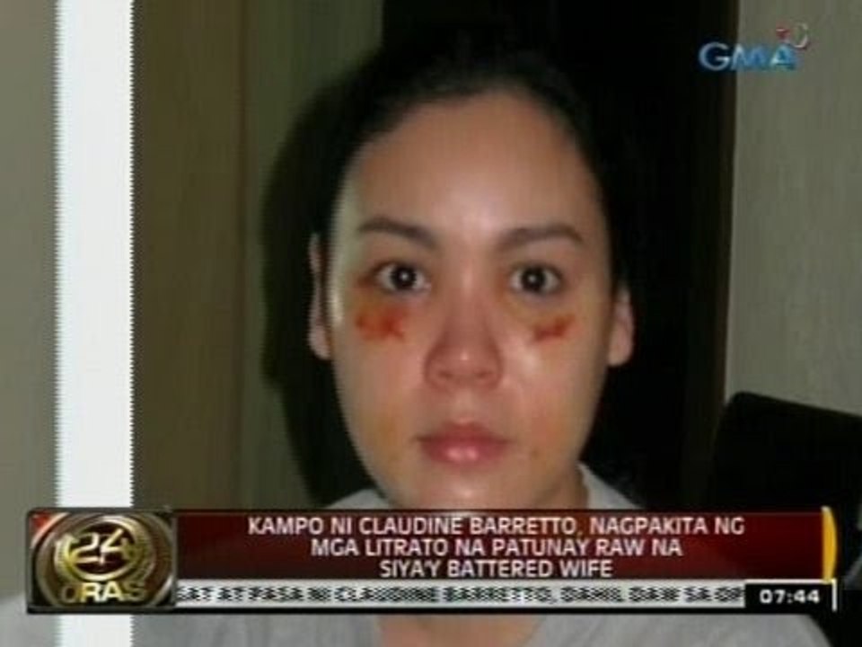 Claudine Barretto, nagka-pasa raw dahil sa post-surgical procedure, ayon kina Raymart Santiago