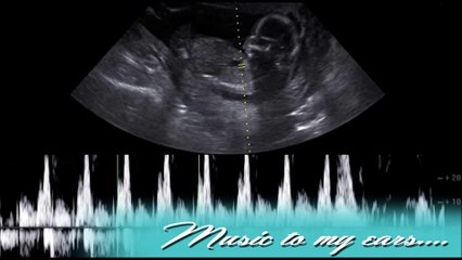 Beautiful Babies 3D-4D Ultrasound - (330) 314-2425