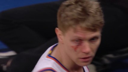 Mindaugas Kuzminskas Takes Shot to the Eye