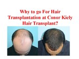 About Dr Conor Kiely Reviews | Conor kiely Hairtransplant