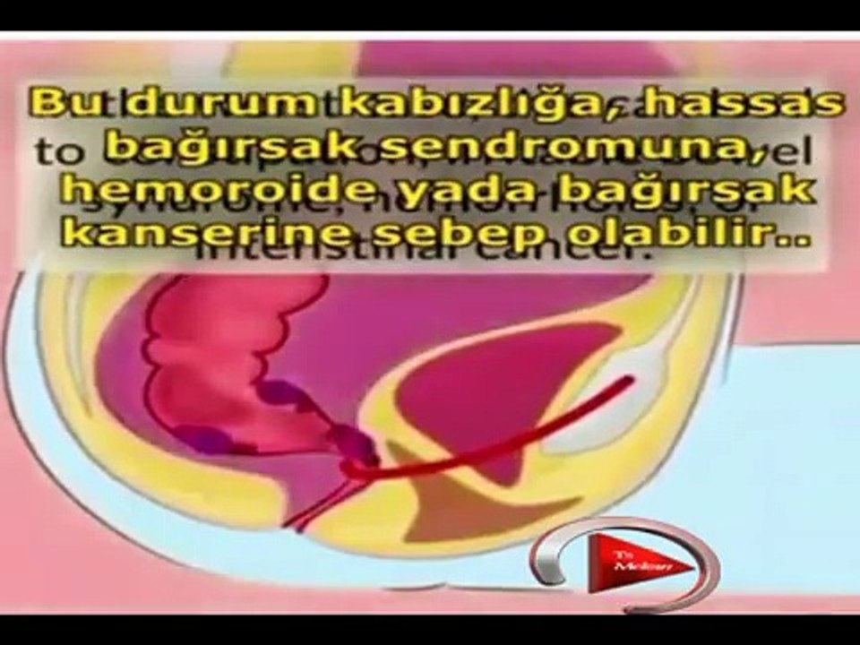 KLOZETLİ TUVALETTE NASIL OTURMALIYIZ VE NEDEN
