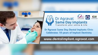 All On 4 Dental Implants Procedure Animation