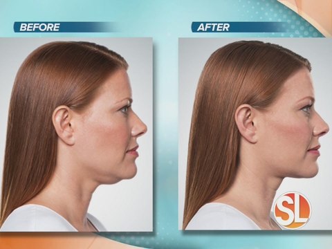 North Valley Plastic Surgery offers full correction treatments with no surgery, no downtime