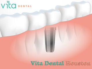 Vitadentalhouston.com Company Introduction Video