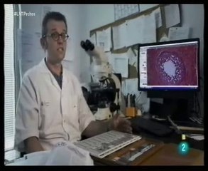 ¿Cancer de mama?: Biopsia (Anatomia patologica)