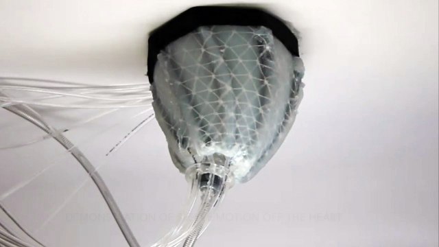 Soft Robots Hug the Heart to Help Pump Blood