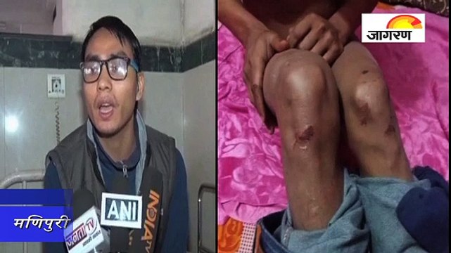 मणिपुरी युवक : कंपनी के CEO पर मारपीट का आरोप लगाया