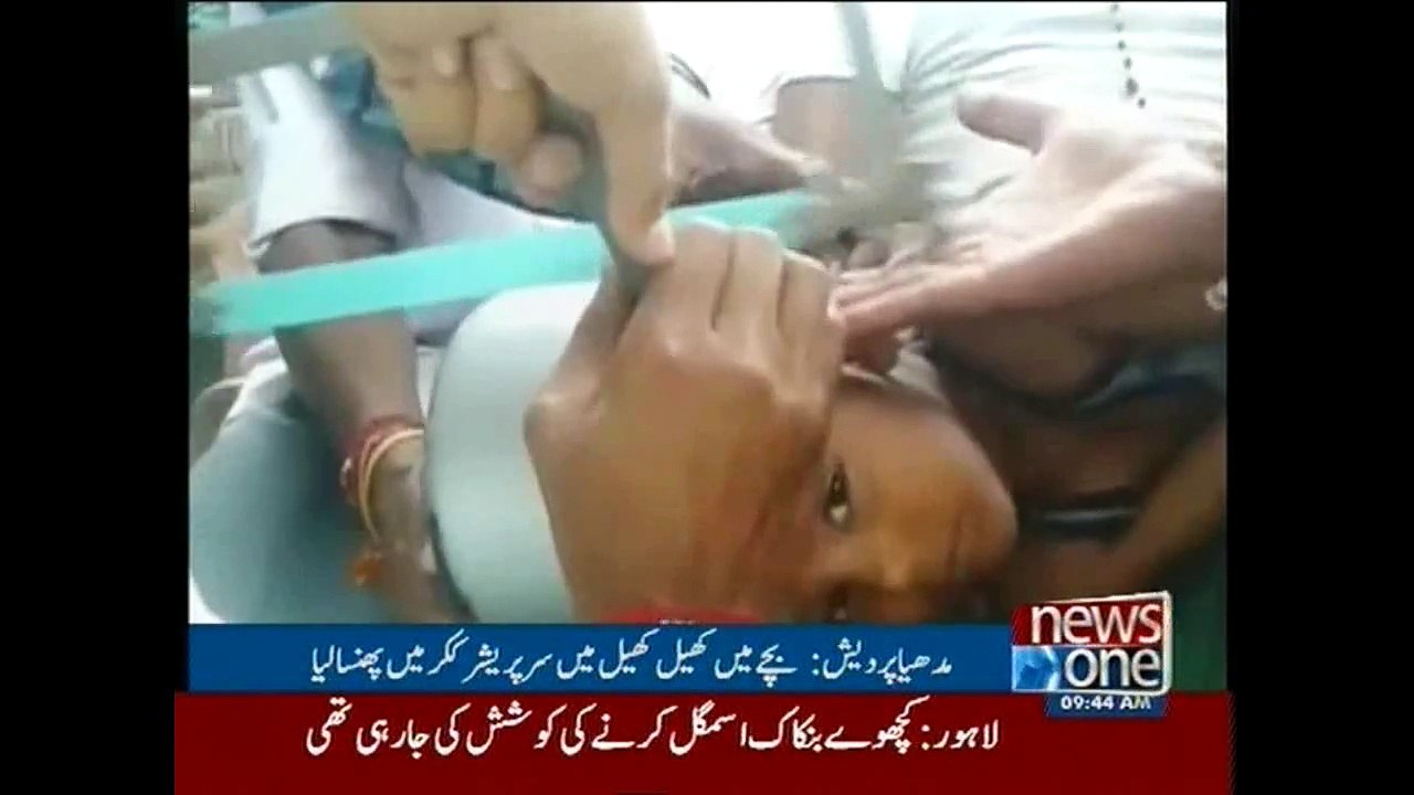 5-year-old child head stucks in pressure cooker