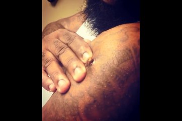 Ce rappeur expulse une balle de son bras.