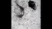 White Blood Cells attacking a Parasite - Brutal