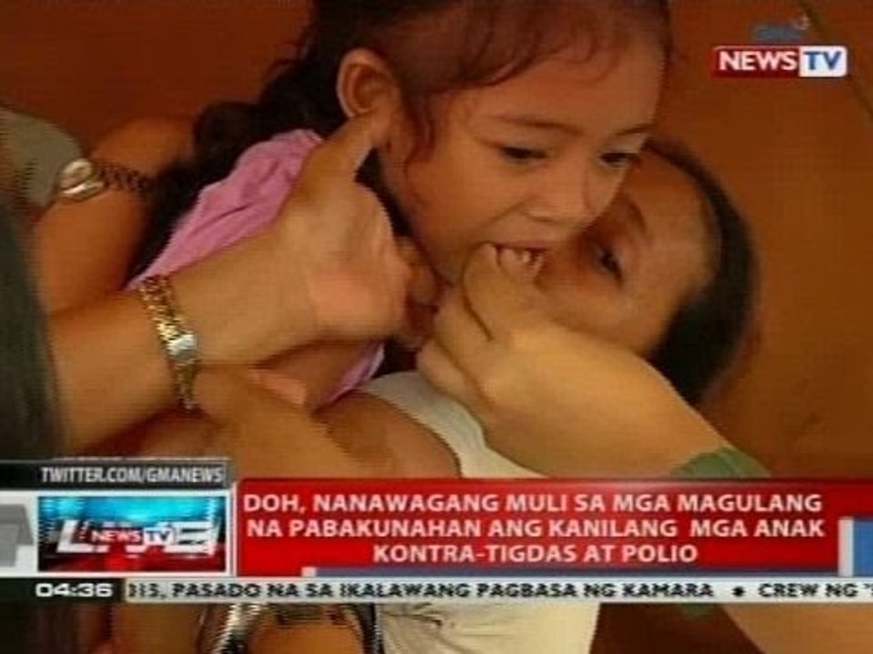DOH, nanawagang muli sa mga magulang na pabakunahan nag kanilang mga anak kontra-tigdas at polio