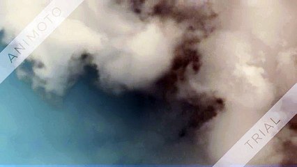 Diabetes Hospital In Chennai