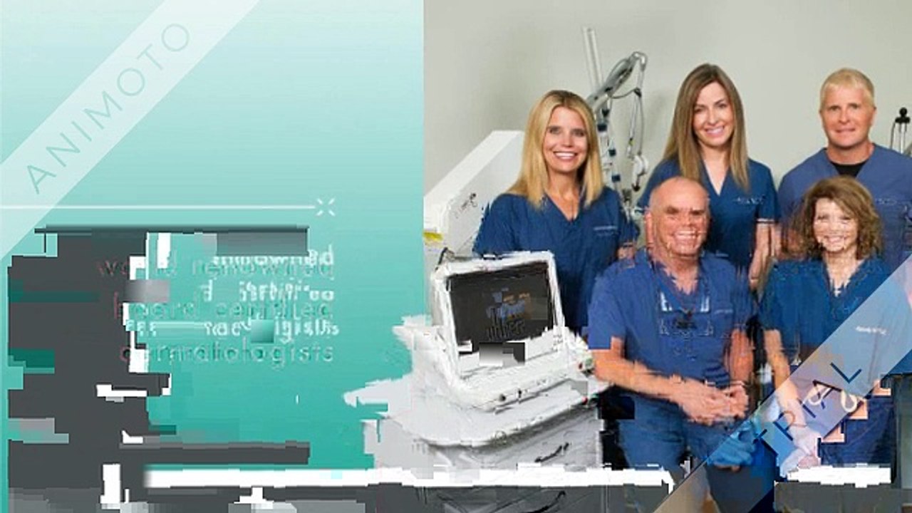 Spider Veins Removal