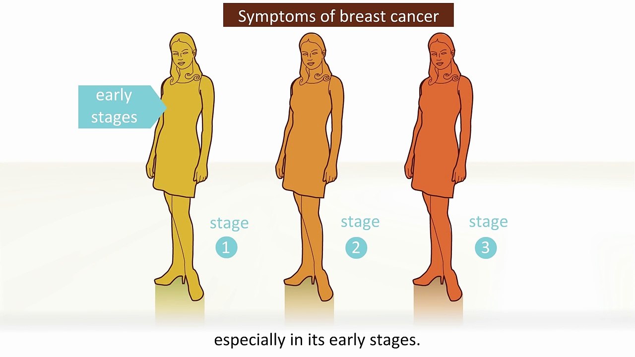 Breast cancer - Symptoms and treatment -