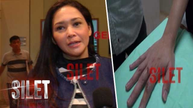 Kabar Mengejutkan, Jari Tangan Maia Estianty Robek - Silet 21 Januari 2017