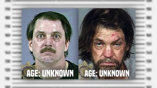 10 Shocking Before And After Drug Use Photos-DF4ogmT-yok