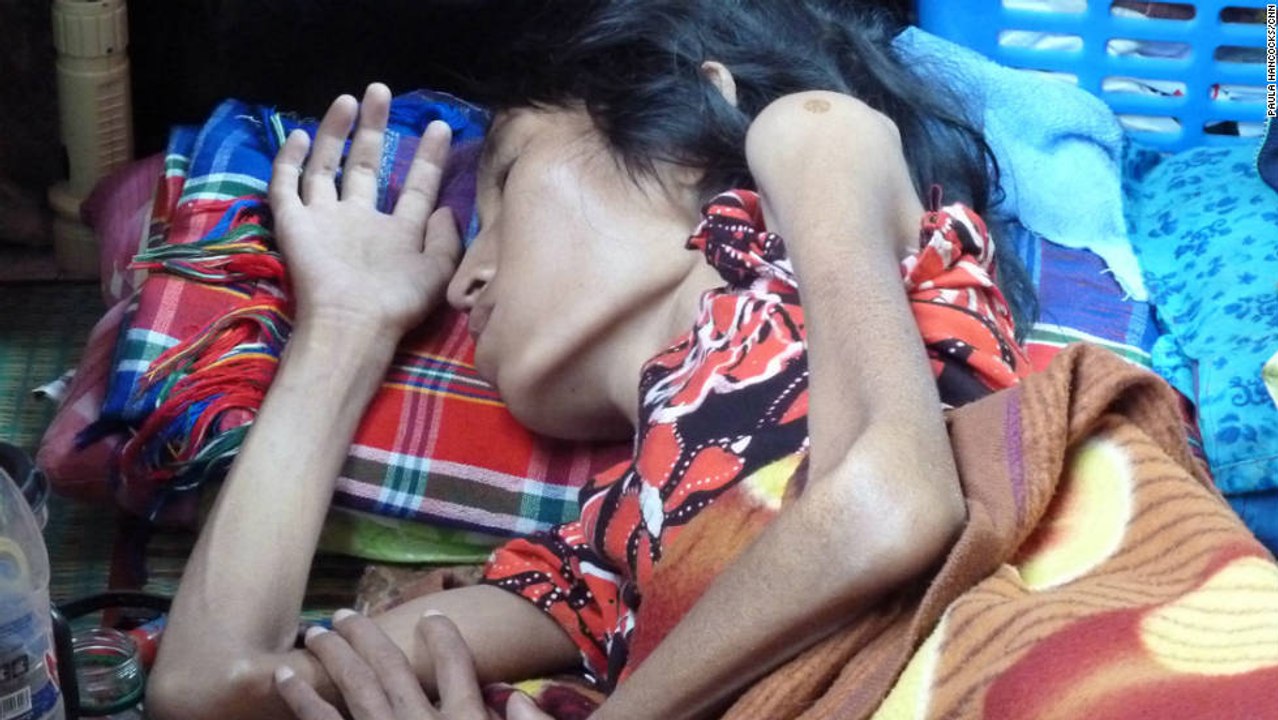 pakistani female model suffering from AIDS find out in this video