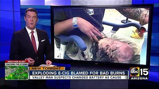 Phoenix man burned after electronic cigarette explodes in pocket
