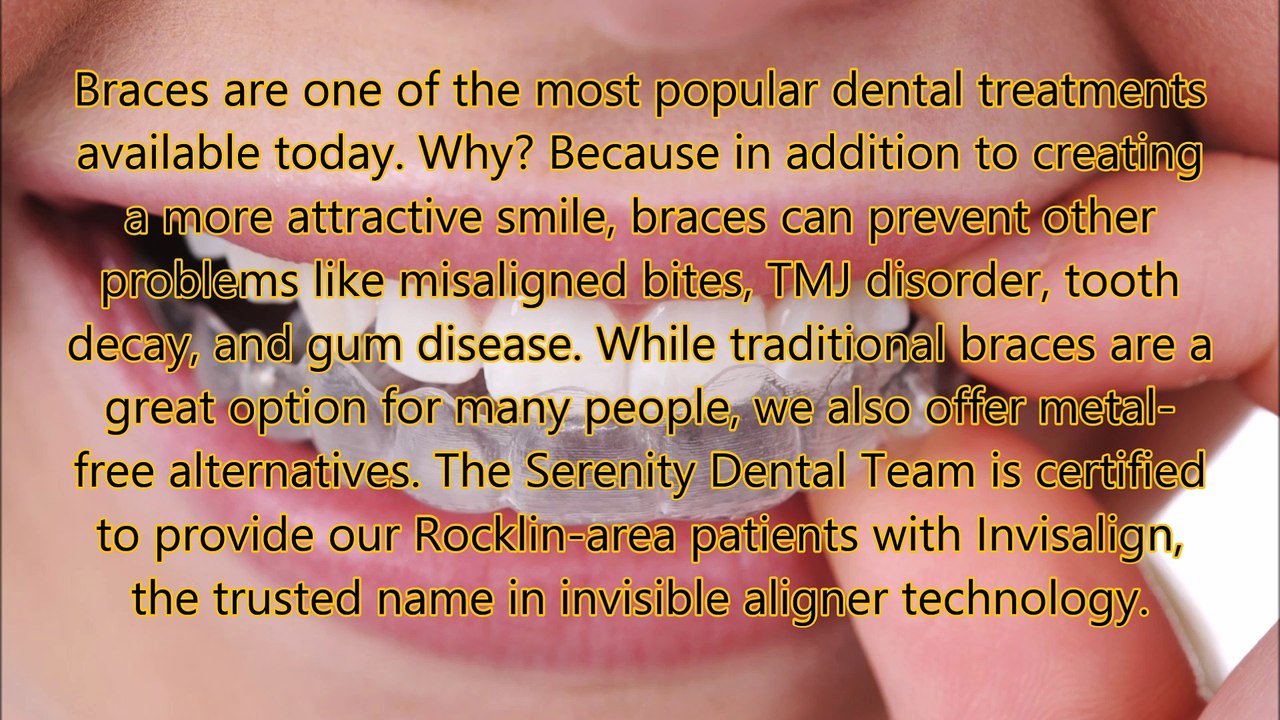 Serenity Dental (Invisalign)