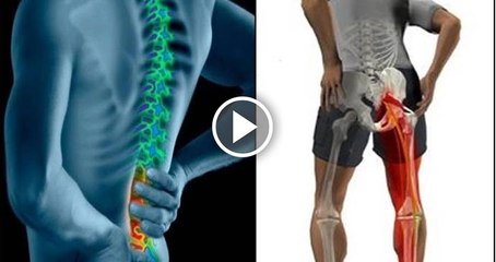 Sciatica Pain Treatment | Home Remedies for Sciatica