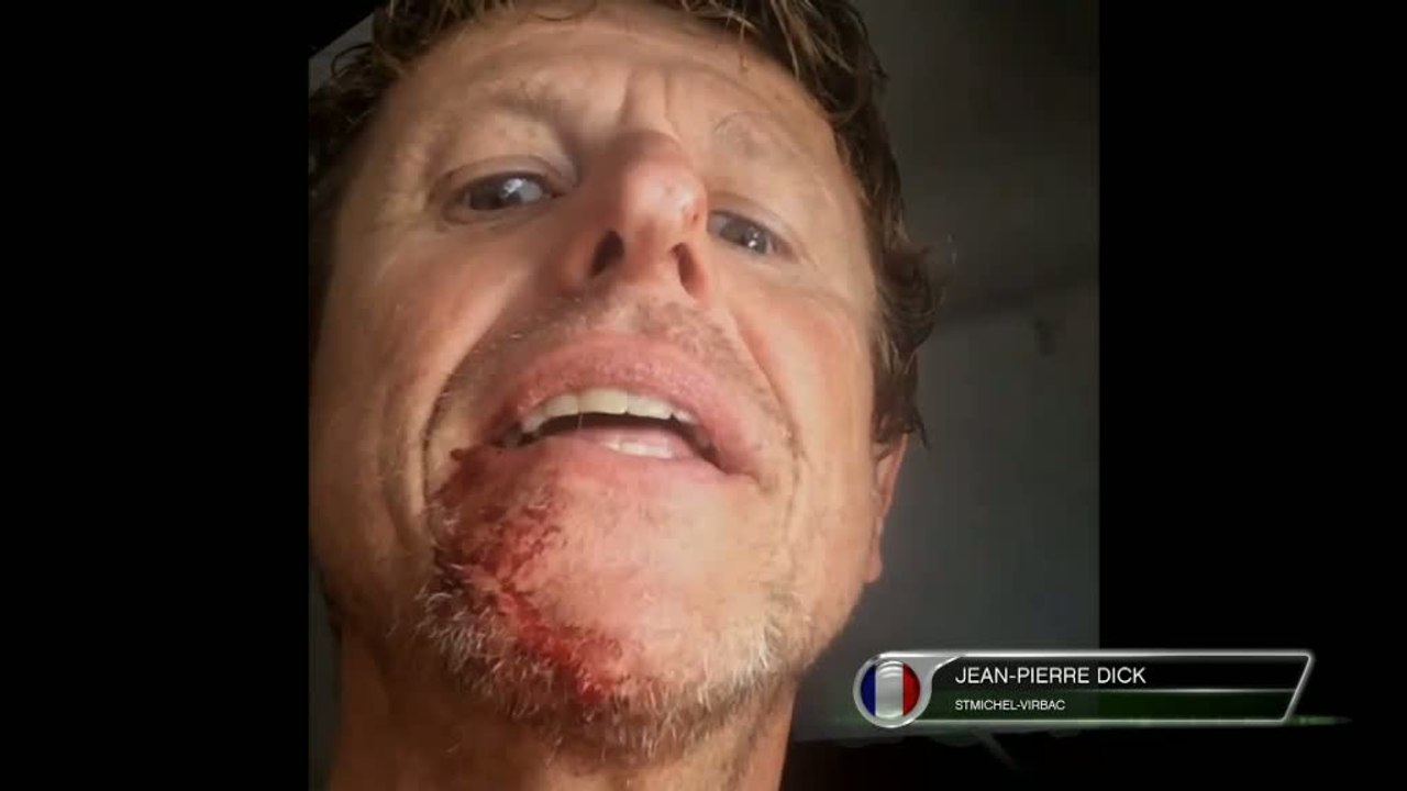 Voile - Vendée Globe : Blessé, Dick se pose des agrafes !