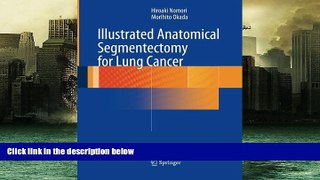 Read Online Illustrated Anatomical Segmentectomy for Lung Cancer Hiroaki Nomori For Kindle
