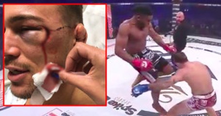 Rakibinin Yüzüne Attığı Tekme Sonrasında Turnuvalardan İhraç Edildi