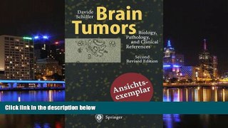 Read Online Brain Tumors: Biology, Pathology and Clinical References Davide Schiffer For Ipad