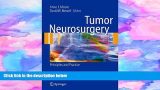 PDF  Tumor Neurosurgery: Principles and Practice (Springer Specialist Surgery Series)  Trial Ebook