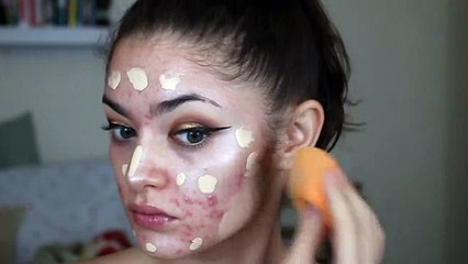 O Poder Da Maquiagem Em Pele Acnenosa