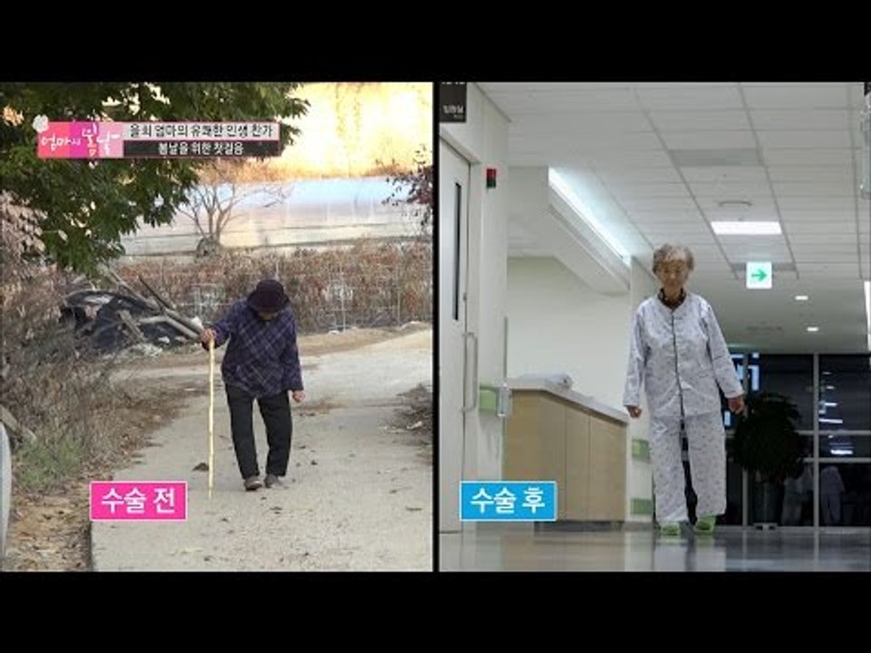 엄마의 수술 전VS수술 후 [엄마의 봄날] 68회 20161218