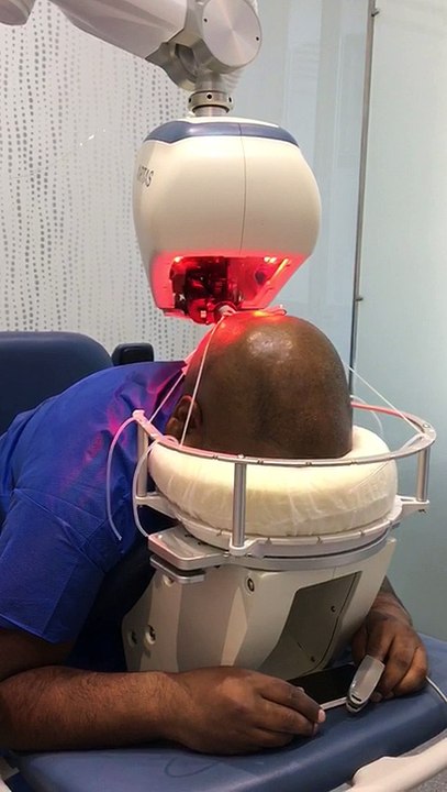 Prélèvement_implants_capillaires_Afro_ARTAS_TheClinic